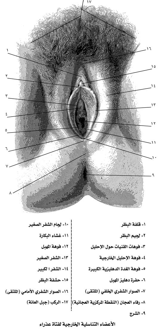 تعليق