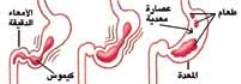 هضم.jpg