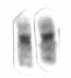 Human male karyotpe high resolution - Chromosome 19 cropped.png