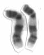 Human male karyotpe high resolution - Chromosome 9 cropped.png