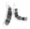 Human male karyotpe high resolution - Chromosome 14 cropped.png