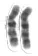 Human male karyotpe high resolution - Chromosome 10 cropped.png
