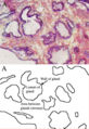 Prostate under a microscope This image shows the microscopic glands of the prostate