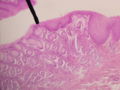Microscopic shot of a cross section of human gastro-esophageal junction wall.