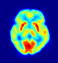 A flat oval object is surrounded by blue. The object is largely green-yellow, but contains a dark red patch at one end and a number of blue patches.