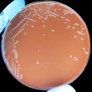 Haemophilus influenzae.jpg