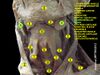 Submandibular gland