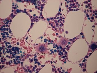 WVSOM Megakaryocytes.JPG