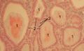 Thyoid histology