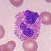 Eosinophil.jpg
