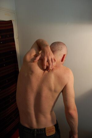 Itch 01.JPG