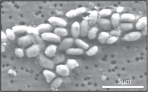 GFAJ-1 (grown on arsenic).jpg