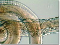 Trichurisspmale.jpg