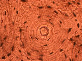 Whorled: Multiple concentric objects, or spiral-shaped