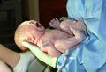 Newborn child, seconds after birth. The umbilical cord has not yet been cut.