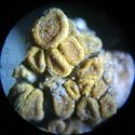 Microscopic view of lichen growing on a piece of concrete dust.[أ]