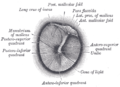 Right tympanic membrane as seen through a speculum.