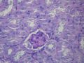 Glomerulus.