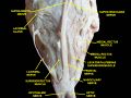 Extrinsic eye muscle. Nerves of orbita. Deep dissection.