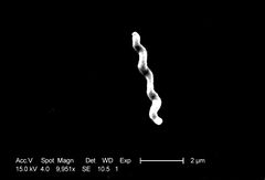 Campylobacter jejuni 01.jpg