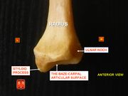 الكعبرة، styloid process - anterior view