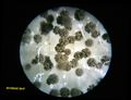 Mold grown from a nasal mucus sample.  10× objective, 15× eyepiece; each numbered tick is 122 µM.