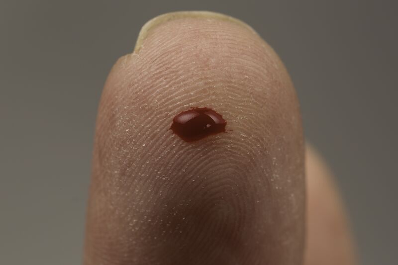 ملف:Blood Test (15575812743).jpg