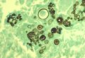 Spherule and endospore forms of Coccidioides immitis 01ee057 lores.jpg