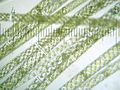 Spirogyra