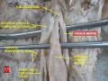 Vagus nerve – dissection