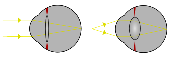 Focus in an eye.svg