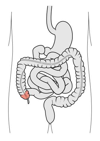 Tractus intestinalis cecum.svg
