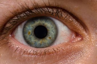 Human eye with blood vessels.jpg