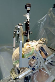 The placebo effect can be produced by inert tablets, by sham surgery, and by false information, such as when electrical stimulation is turned “off” in those with Parkinson’s disease implanted brain electrodes[1]