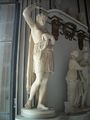 Wounded Amazon, Musei Capitolini, Rome.