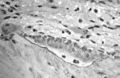 Light micrograph of decalcified (a process that removes the mineral) cancellous bone displaying osteoblasts actively synthesizing osteoid, containing two osteocytes.