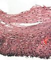 H&E stain of biopsy of normal esophagus showing the stratified squamous cell epithelium