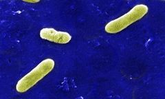 Bordetella bronchiseptica.jpg