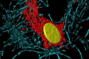 Fibroblast (BPAE).jpg