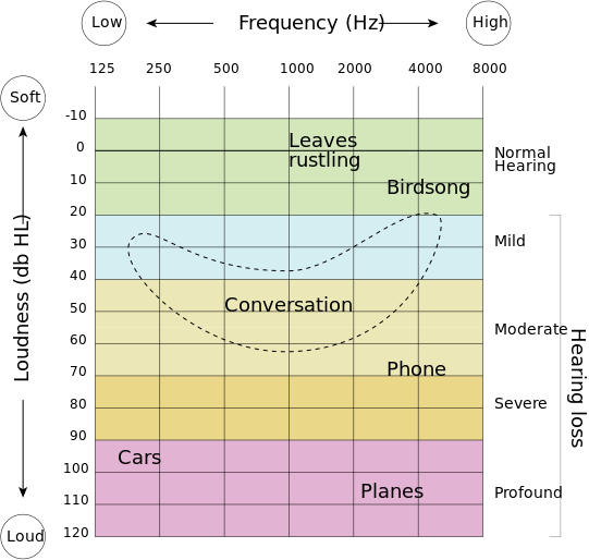 ملف:HearingLoss.svg