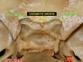 Optic canal