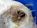 Superior rectus muscle