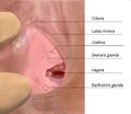 Female urethral opening within vulval vestibule