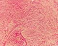 This variant of Van Gieson's stain distinguishes muscle (yellow) from connective tissue (red)