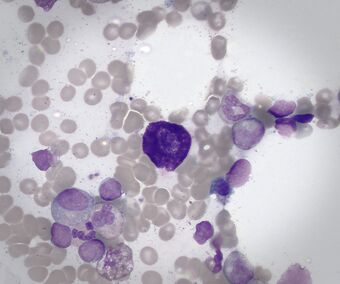 Mastocyte.jpg