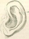 1871 Descent F937.1 fig03.jpg