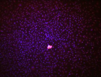 CD34EndothelialCell.jpg