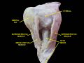 Extrinsic eye muscle. Nerves of orbita. Deep dissection.