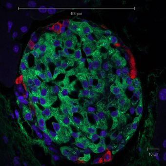 Mouse islet LM SolimenaLab.jpg