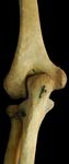 Left Human Posterior Distal Humerus Extended